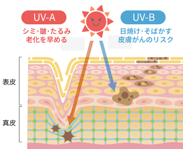 紫外線によるリスク
